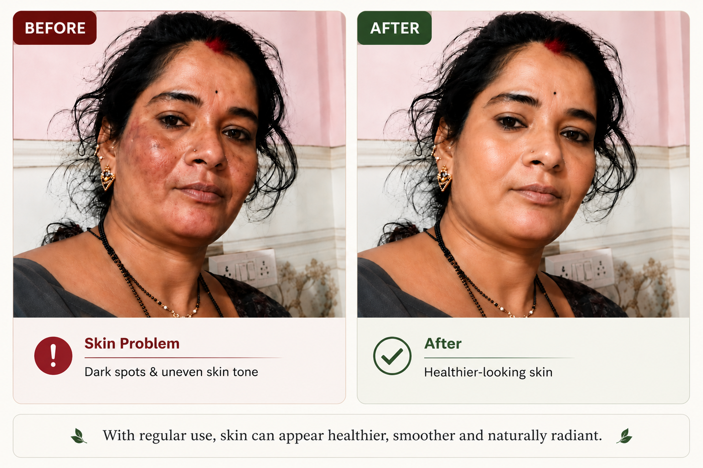 Before and after: a customer's dark spots and uneven skin tone appear healthier with regular use