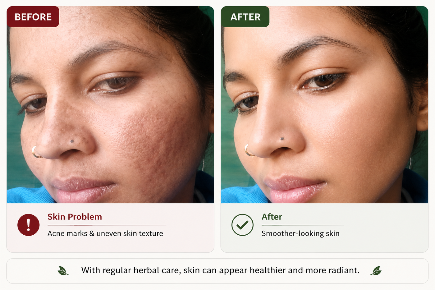 Before and after: a customer's skin appears smoother and more even with regular use
