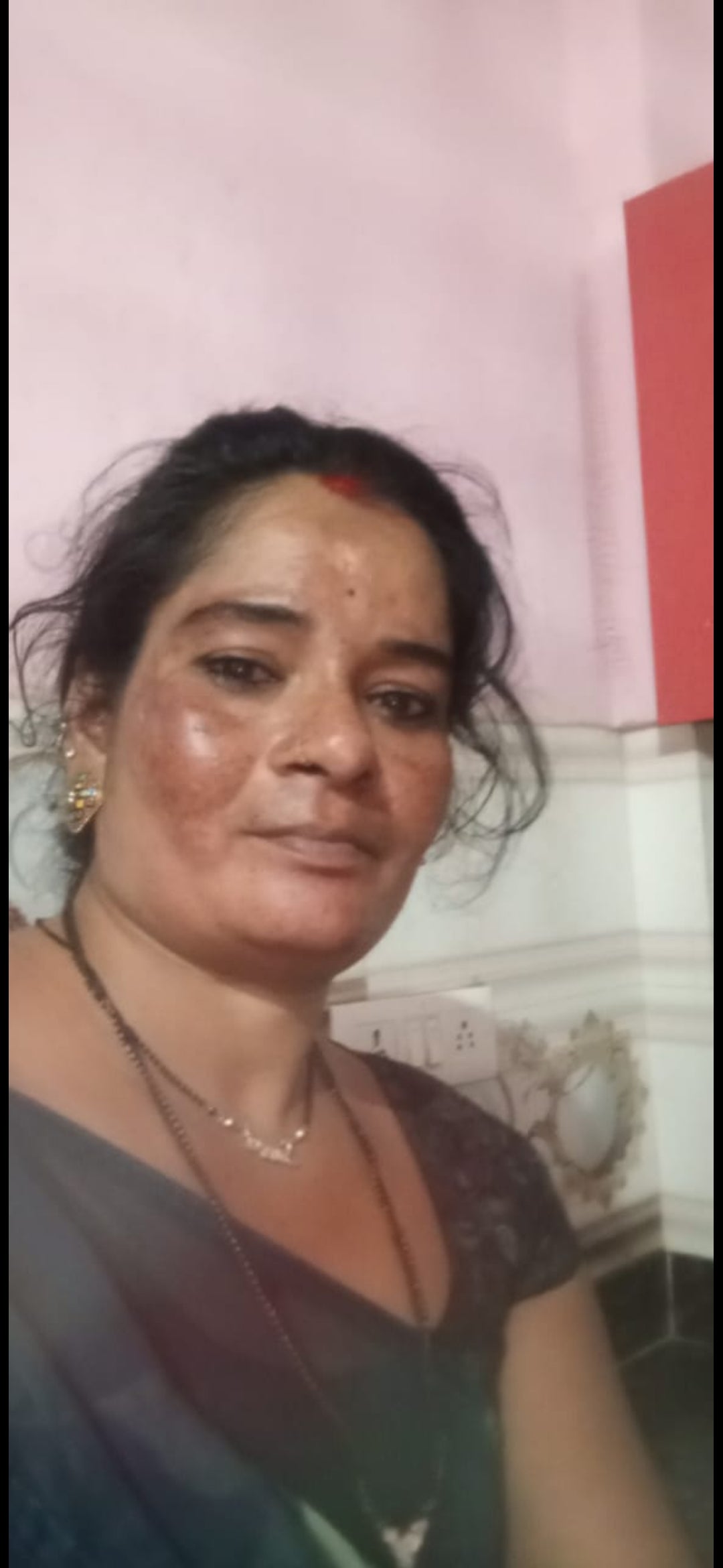 Real VaidicHerb customer showing redness and sensitive skin concern